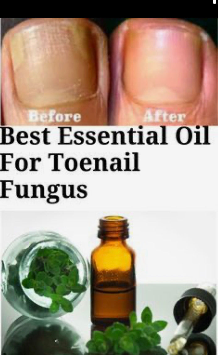 Fungus oil